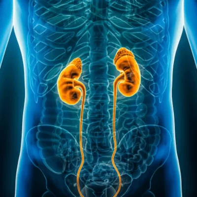 Renal care